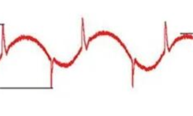 抑制開關(guān)穩(wěn)壓器EMI：不用濾波電路，還有什么好方法？